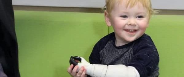 Un papa imprime une prothèse en 3D pour son nourrisson handicapé | Robots et Compagnie – RP
