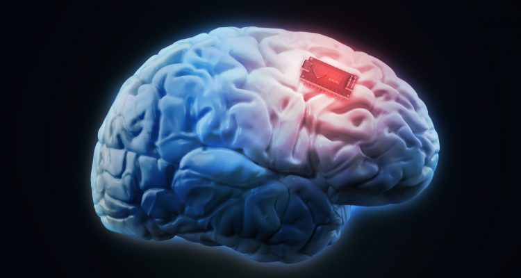 Des scientifiques ont amélioré la mémoire humaine avec un implant cérébral pour la toute première fois | Trustmyscience
